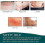 Silicone Scar Tape for Surgery, C-Section, Keloids, Burns - 4cm x 3m 2