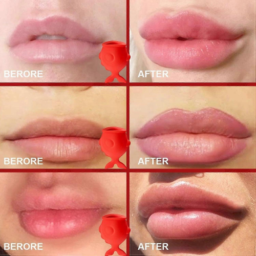 Σιλικόνης Lip Enhancer Plumper - Εργαλείο αναρρόφησης χειλιών - Μακράς Διάρκειας Lip 1