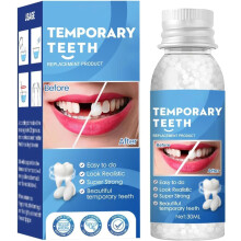 Fix Broken or Missing Teeth with a Temporary Filling Repair Kit - Bridges Gaps and Replaces Chipped Teeth with False Teeth and Fillers