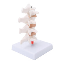 Professional PVC Osteoporosis Human Spine Model for Teaching Demonstration