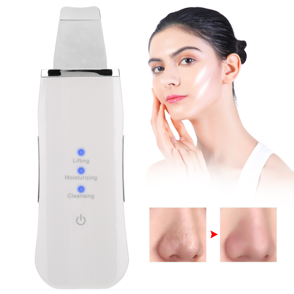 White Usb Rechargeable Face Skin Scrubber 2W Exfoliating Peeling Machine (White)
