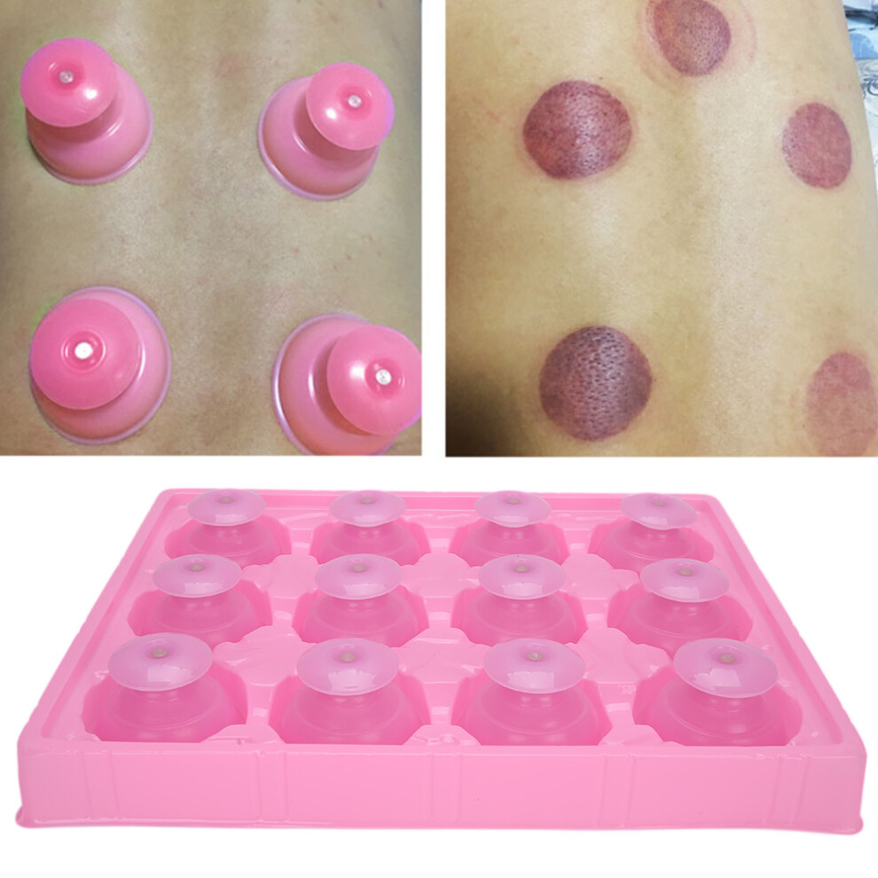12pcs Silicone Vacuum Cupping Set for Therapy & Wellness, 6.5cm
