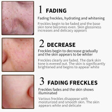 Freckles Fading Cream Anti-Wrinkle Spots Moisturizing Face 30g