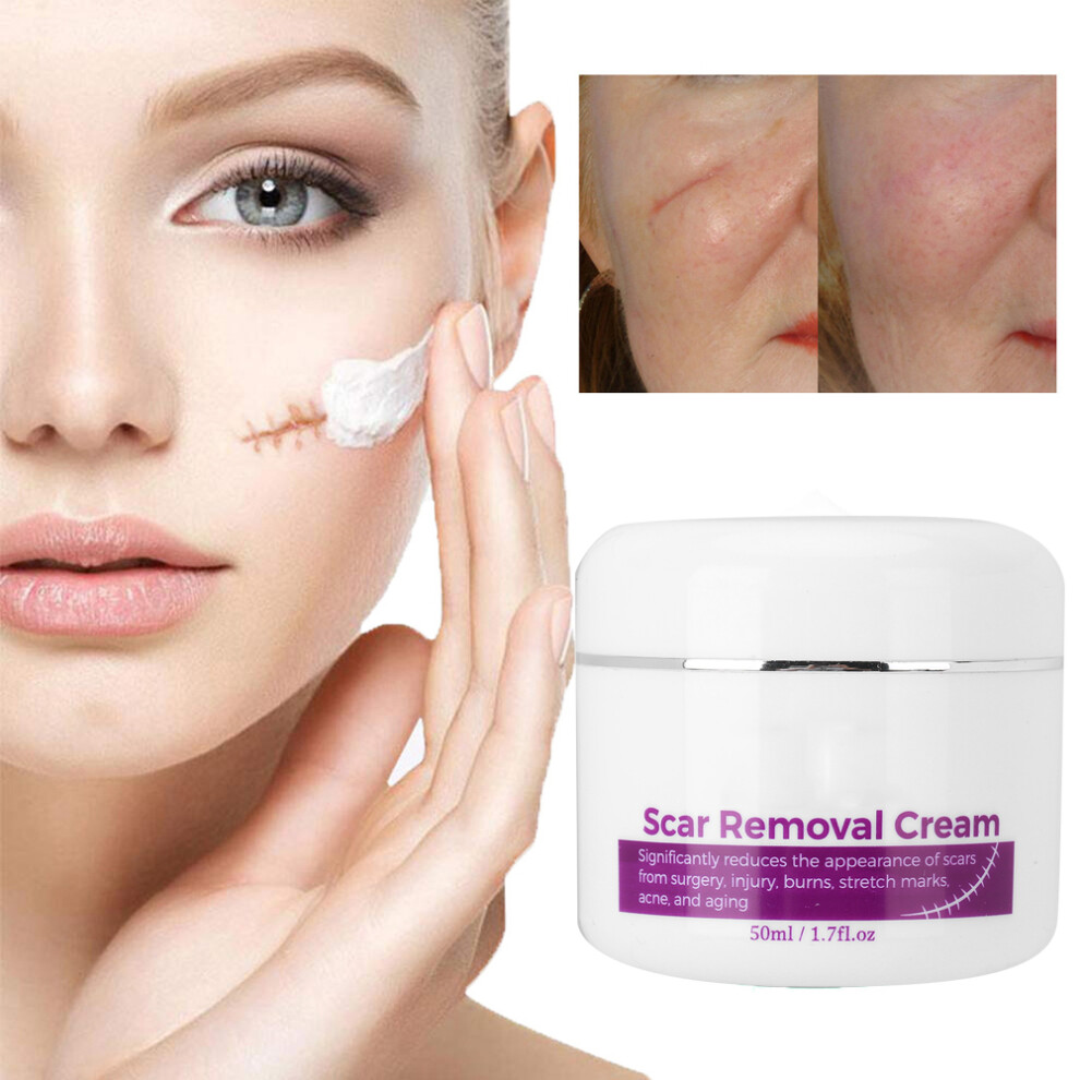 Cream Scar Removal 50Ml For Stretch Marks & Scar Repair, Plant Serum