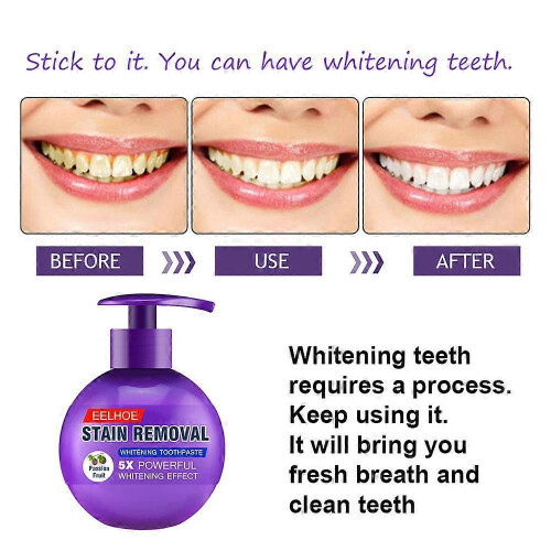 (Blue)Baking Soda Toothpaste Stain Removal Teeth Cleaning Brightening Pump Toothpaste cleaning Teeth 2023 new 1
