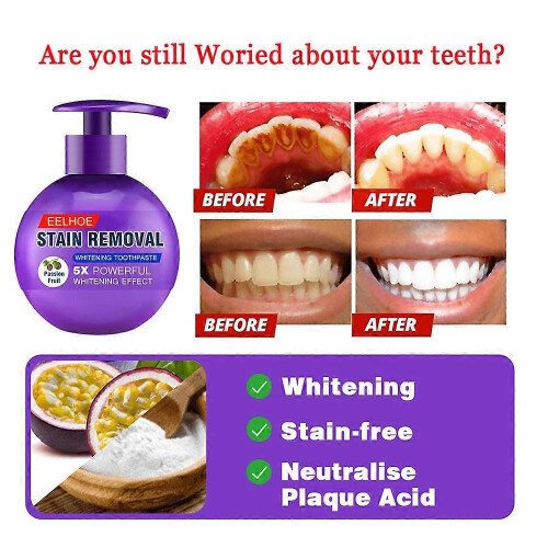 (Blue)Baking Soda Toothpaste Stain Removal Teeth Cleaning Brightening Pump Toothpaste cleaning Teeth 2023 new 2