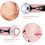 EMS Red Blue Light Therapy Face Machine – 4W, 500mAh, USB Rechargeable 8
