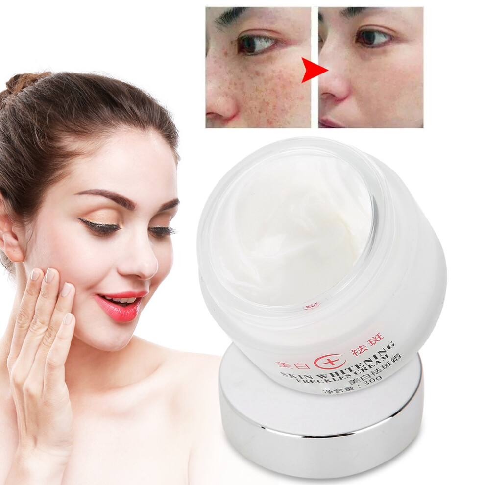 Cream/Dark 30G Brightening For Spots & Melasma, Freckle Removal