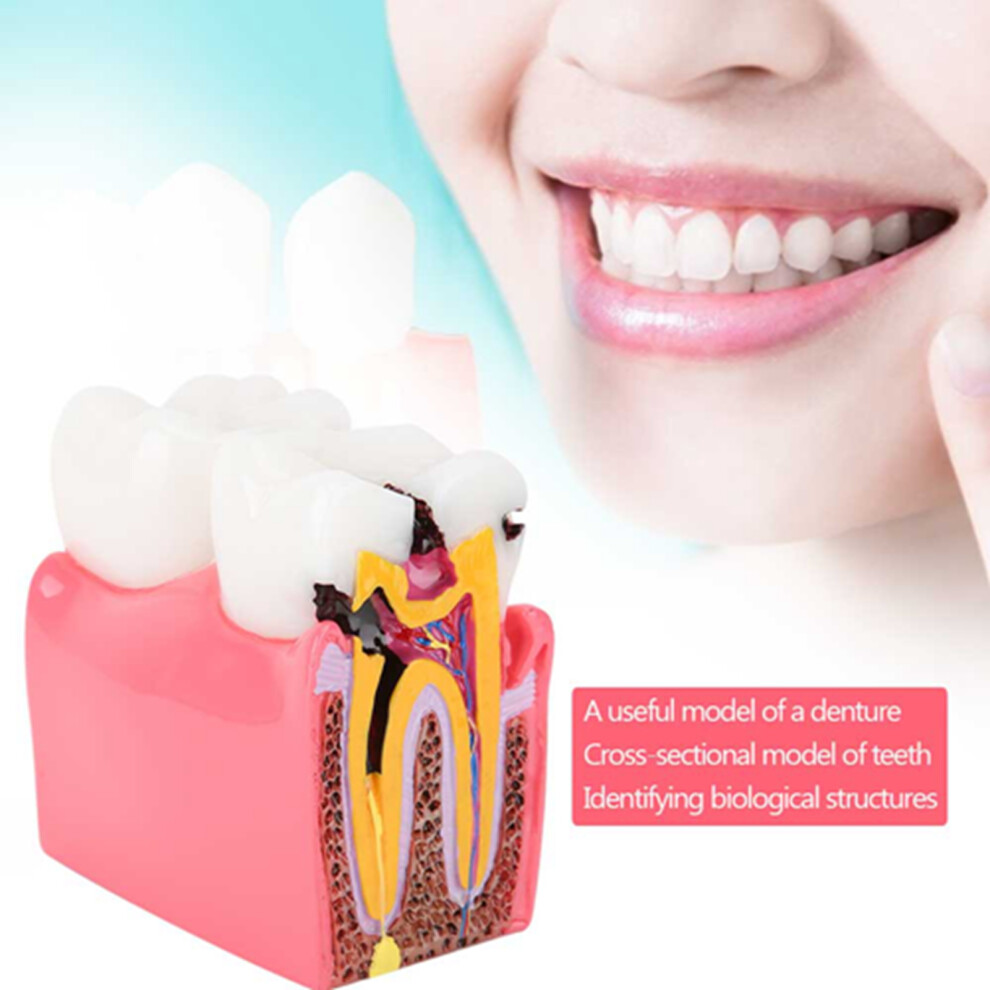ModÃ¨le Anatomique Dentaire - Ãtude Caries pour Dentistes