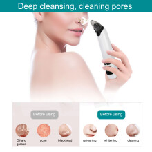 Handheld Blackheads Removal Machine, 3 Gears, White, 17.2cm