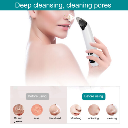 Handheld Blackheads Removal Machine, 3 Gears, White, 17.2cm