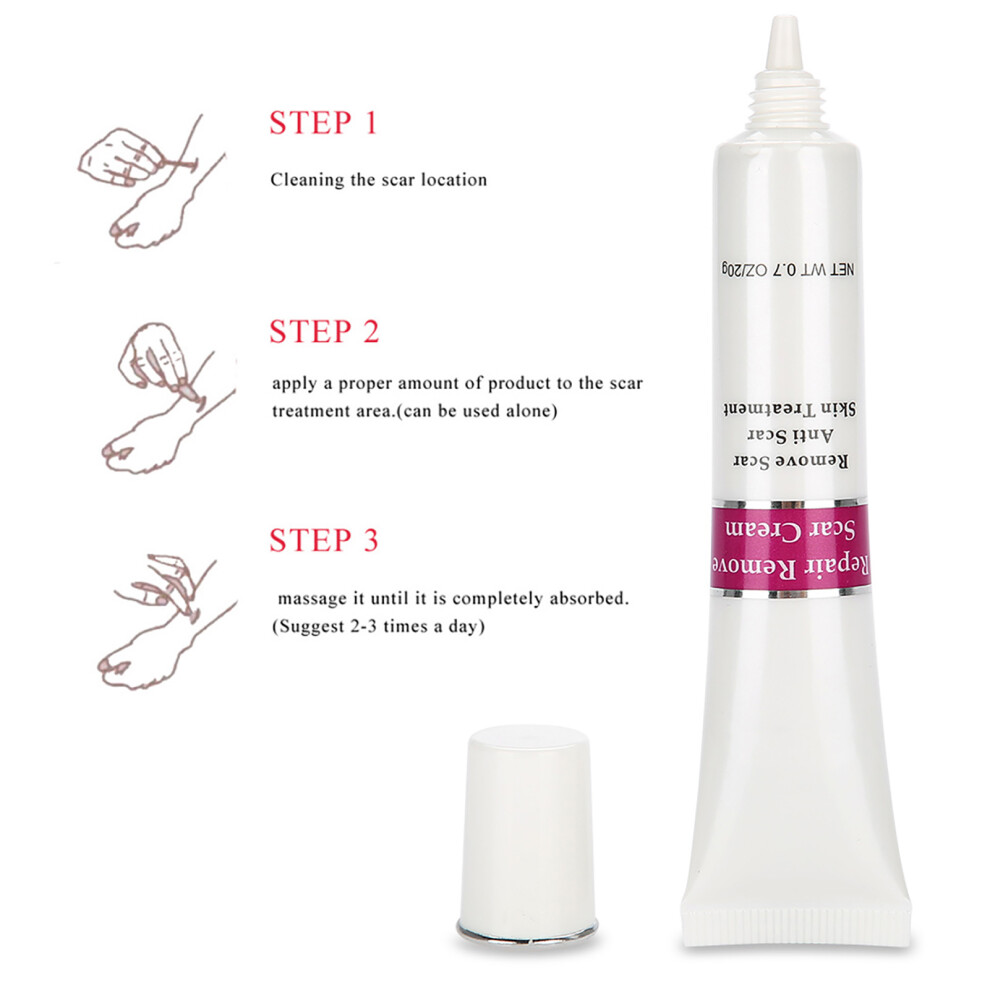 Cream Scar Removal 20G Face Skin Repair Anti Scar & Stretch Marks Treatment