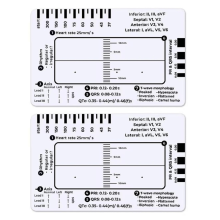 2 ECG rulers with 7 steps, ECG rulers with 7 steps for ECG/EKG interpretation