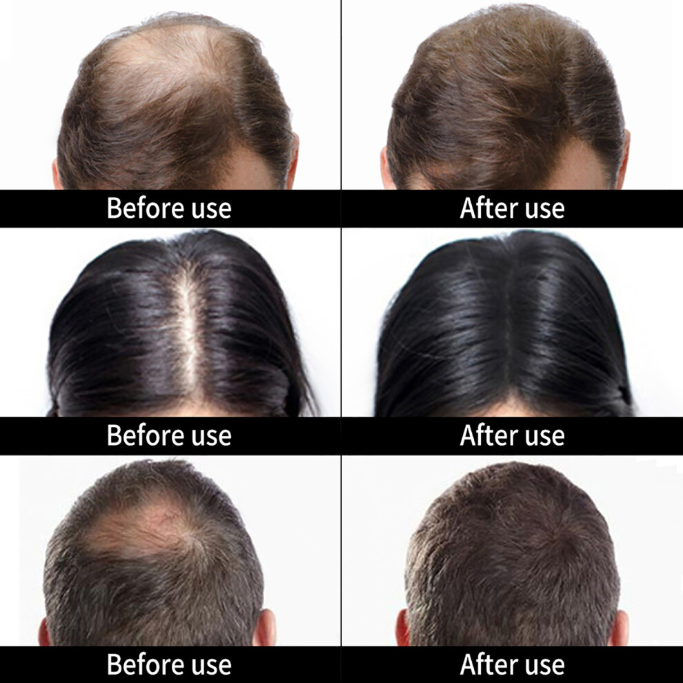 Black Hair Building Fiber Refill 50G For Thicker, Fuller Hair In
