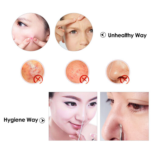 4Pcs Stainless Steel Blackhead Extractor Kit, Compact Acne Pimple Needs 2