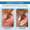 (3pcs) Piercing Aftercare Spray: Saline Solution for Bumps & Fast Healing 4