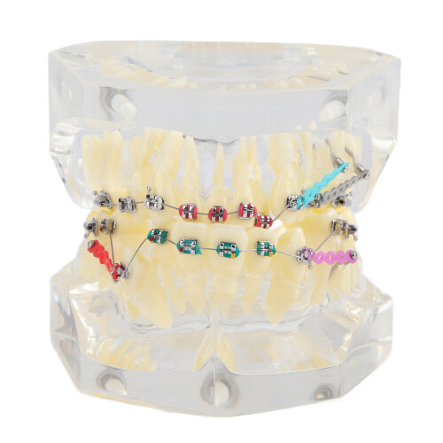 Dental Malocclusion Teeth Model with Wire Chain, 6.5cm 1
