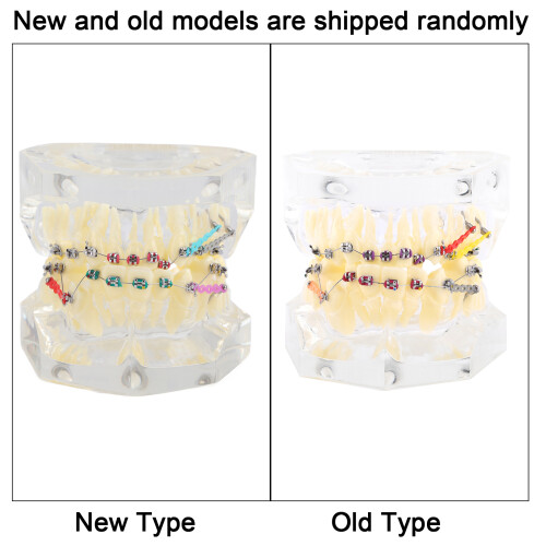Dental Malocclusion Teeth Model with Wire Chain, 6.5cm 2