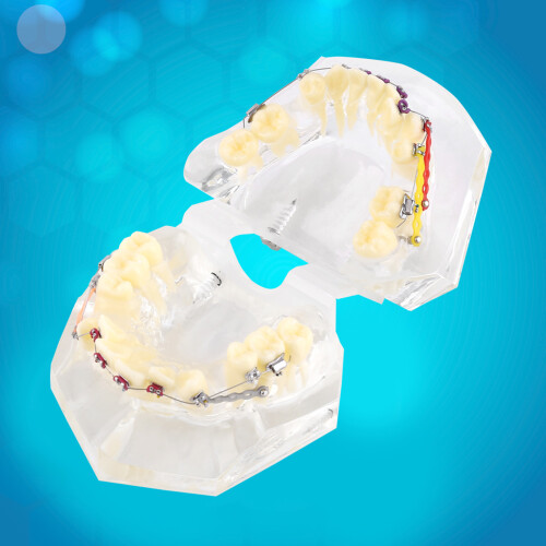 Dental Malocclusion Teeth Model with Wire Chain, 6.5cm