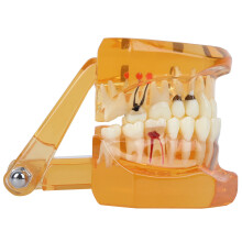 Educational Dental Teeth Model 1pc Orange Removable Use for Teaching and Study