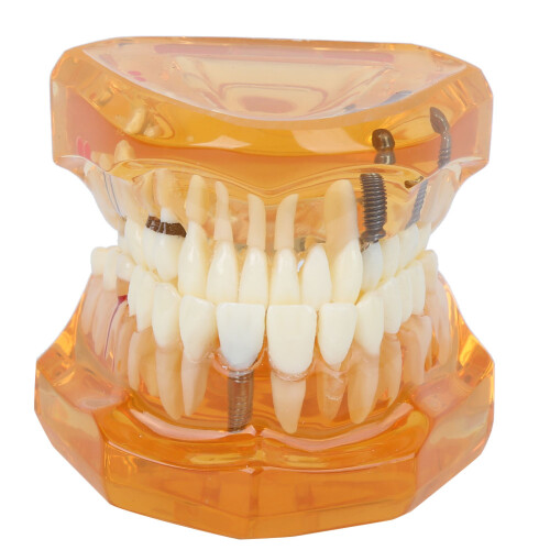 Educational Dental Teeth Model 1pc Orange Removable Use for Teaching and Study 1