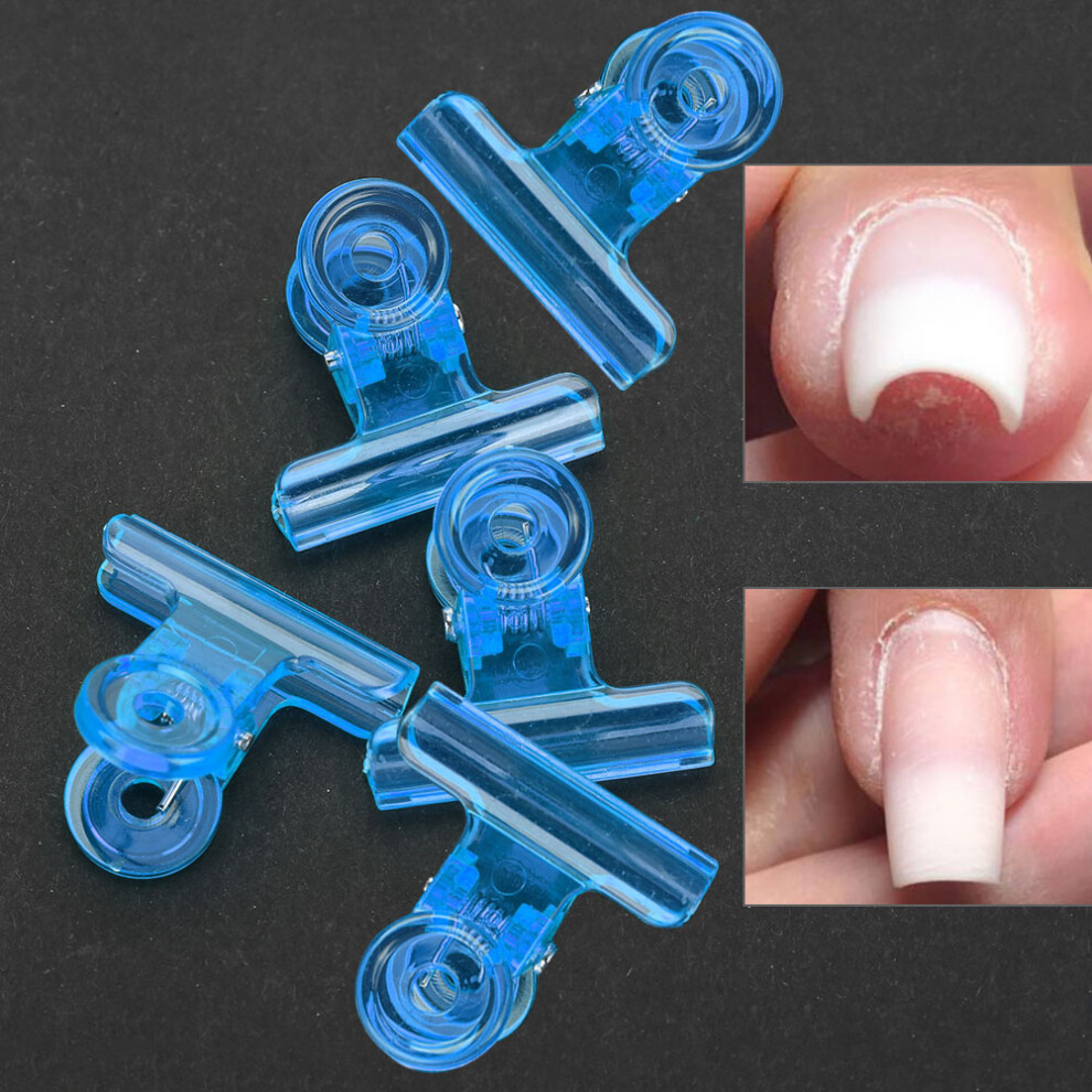 5 Multifunctional Nail Form Clips
