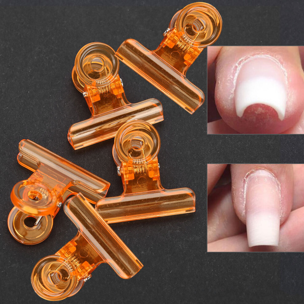5x Plastic C Curve Nail Extension Clips