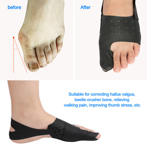Ultra Thin Hallux Valgus Corrector Toe Separator Bunion Fixer S/M/L 2