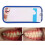 20pcs Roth 022 Slot 345 White Ceramic Brackets 6