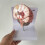 Human Brain Disease Model - Brain Pathology Brainstem Hemorrhage Medical Teaching Model - Human Bra 5