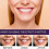 3x 7-Pro Intensive Toothpaste, 7PRO Intense Whitening Toothpaste with 7 Probiotics 4