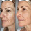 AntiAging Foundation Serum 2 in 1 Coverage with SPF, Hydrating Universal Tint, 2pcs 50ml 5