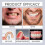 (1pcs) 1/2/3x Advanced Customized Full Denture Set, Silicone Reline Denture Set 4