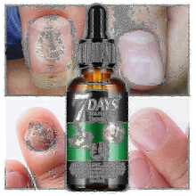 7-Day Nail Fungus Treatment and Growth Serum for Strengthening and Restoring Healthy Nails Naturally