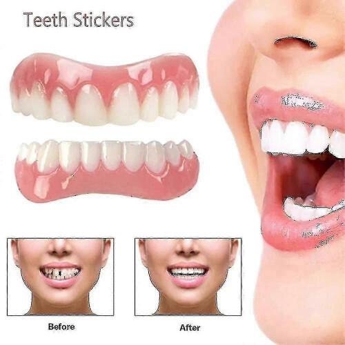 Extra Thin Bright White Tooth Veneers Made from Soft Silicone for Comfortable and Safe Use 1