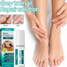 Fungal Nail Treatment for Toenails Extra Strong-Nail Fungus Treatment for Anti