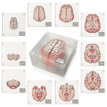 Anatomic Brain Specimen Coasters-Gifts for Medical Student Gifts Brain Decor Human Anatomy Gifts