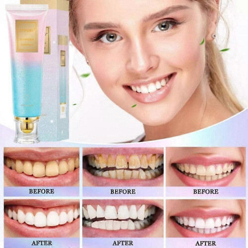 (3pcs)1-3X Niacinamide Whitening Toothpaste Niacinamide Intensive Whitening Toothpaste 1