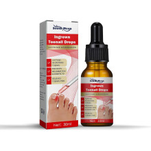 30ml Ingrown Toenail Treatment,nail Treatment,ingrown Toenail Drops Cuticle Oil Ingrown Toenail