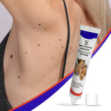 KanyeHB 20g Wart Remover Ointment Skin Tags Corns Remover Restore Safely Without Leaving Scars Refuse Rpeat