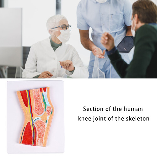 Sectional Anatomical Knee Joint Model For Anatomy Education 1