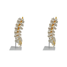 2X Teaching Equipment Model 5-Segment Lumbar Spine with Sacral Accessory Orthopedic Teaching Display Teaching Aids