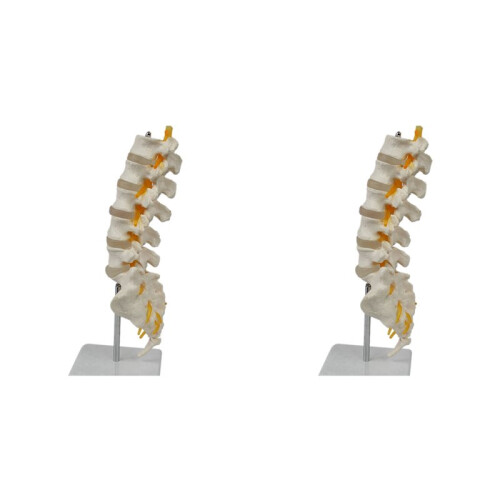 2X Teaching Equipment Model 5-Segment Lumbar Spine with Sacral Accessory Orthopedic Teaching Display Teaching Aids