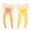 Molar Model Simulated Anatomical Tooth Specimen 1
