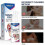 (3pcs)Tinnitus Spray Ear Ringing Relief Relieving Ear Drops Hearing 30ml 1-3x 5