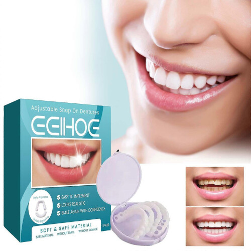 Eelhoe Adjustable Snap-On Denture Temporary Filling Dental Suture Alignment Orthodontic Denture Kit 1
