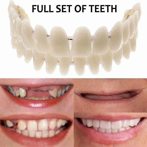 Dental Veneers Dentures Tooth Cover Set - Snap On False Teeth Upper Lower