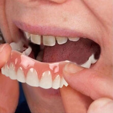 Extra Thin Fake Bright White Tooth Veneers Silic Soft Safe Adhesive Denture Hide Shade Braces Comfortable Teeth Orthodontic