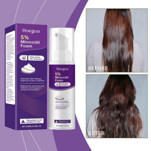 Hoegoa Minoxidil Foam 2