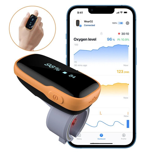 WearO2 Ring Bluetooth Pulse Oximeter with Alarm